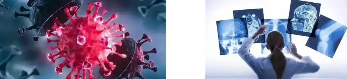 YEAST BETA GLUCAN POWDER YEAST BETA GLUCAN POWDER